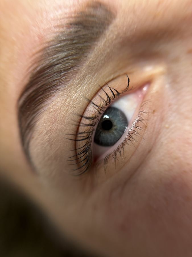 Browlift et sourcils restructurés, vue rapprochée