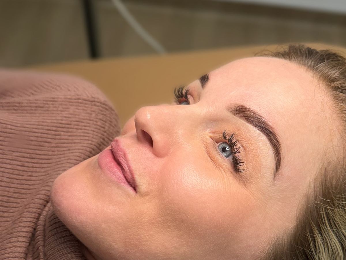 Sourcils restructurés de profil